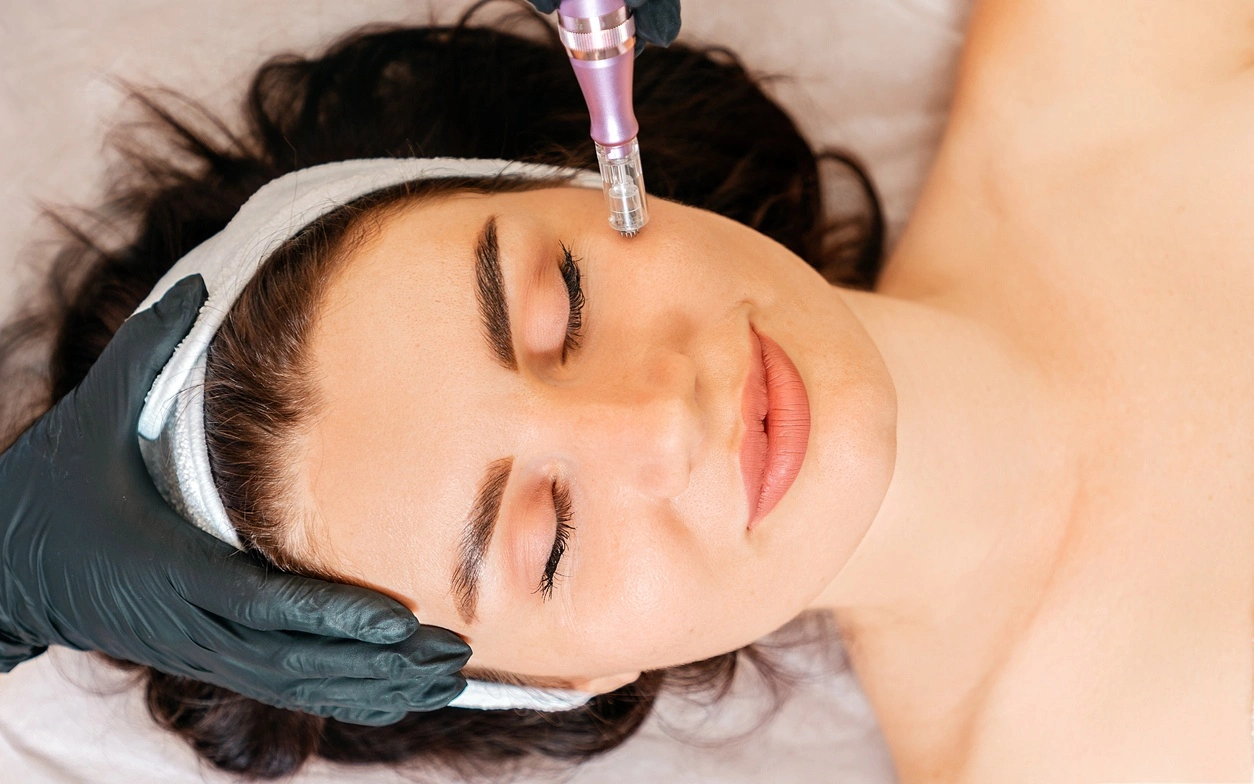 Femme microneedling Femme alongée subissant un soin de la peau